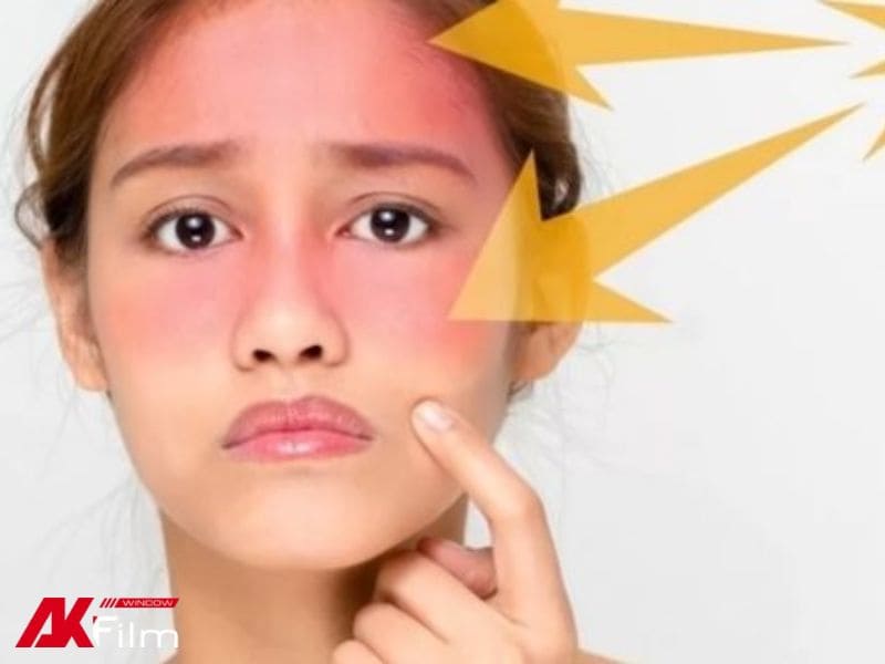 Tác hại của tia UV đối với làn da